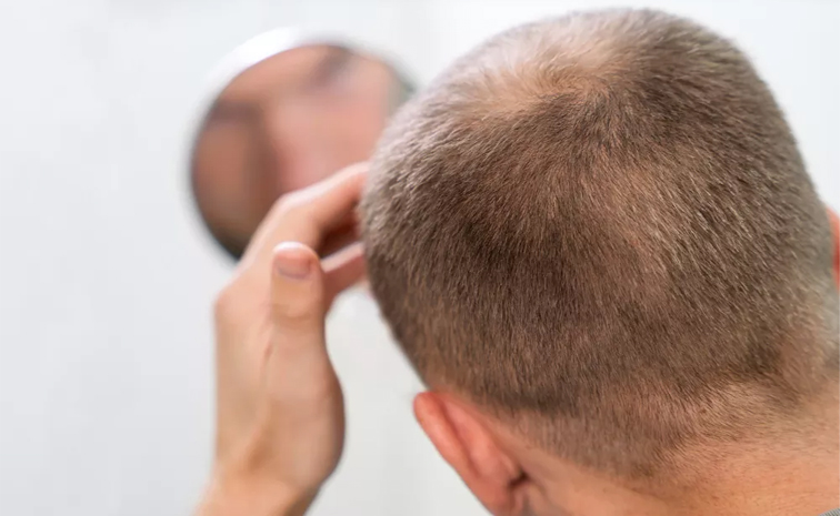 bald_20head.jpg
