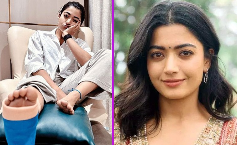 rashmika-leg-injury-update.jpg