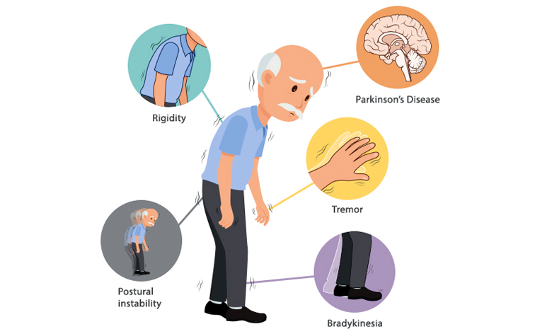 Parkinson_20disesase1.jpg