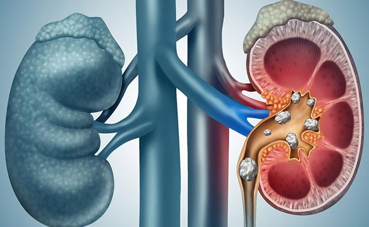 Kidney.jpg