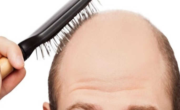 baldhead-hair.jpg