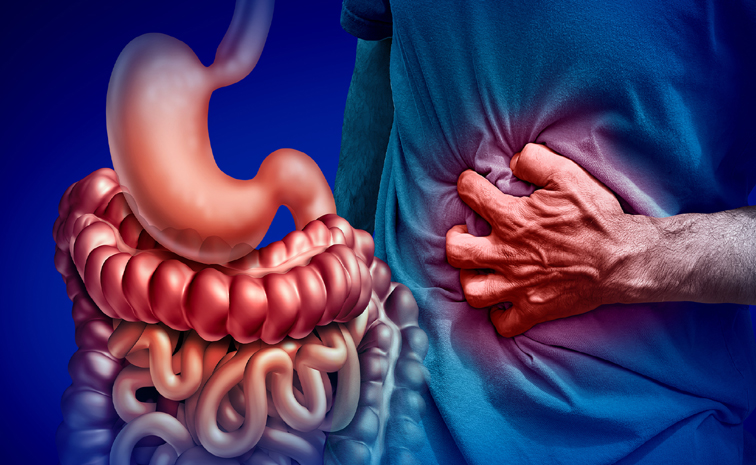 IBD.jpg