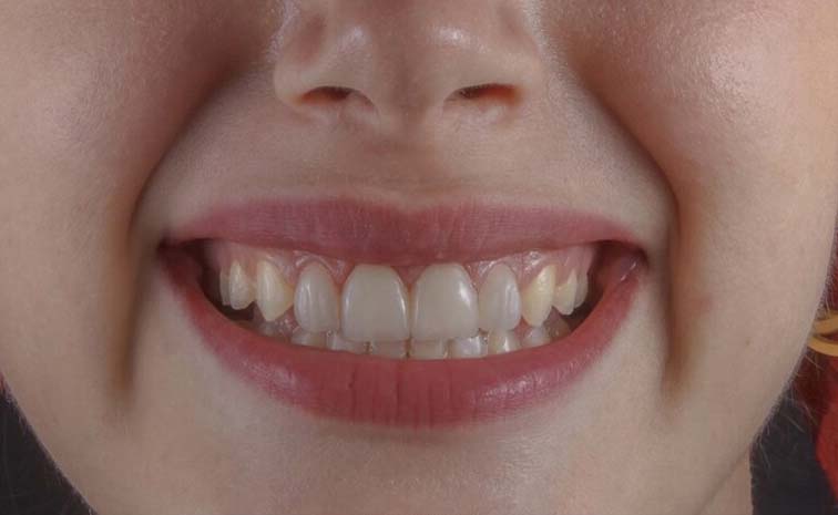 Teeth.jpg
