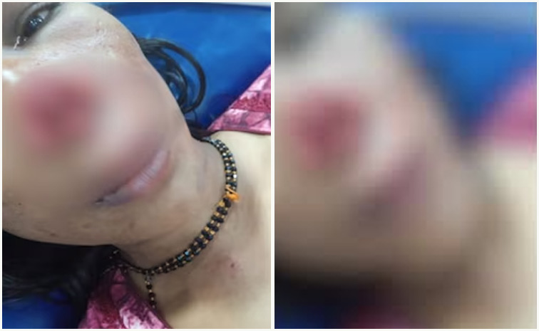 Wife-Nose1.jpg