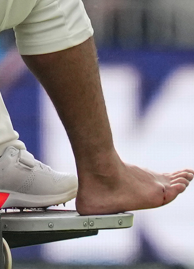 Rishabh_20Pant_20injury_20fourth_20test_20India_20and_20England_20Photos_17.jpg 16