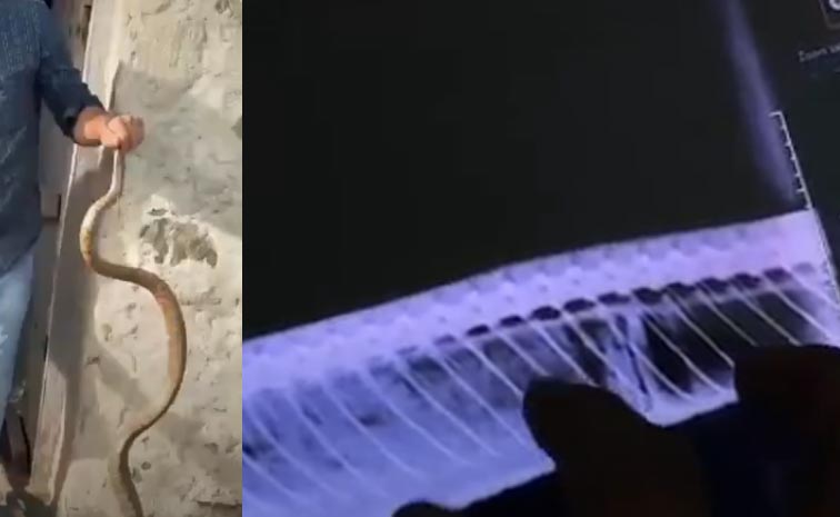 Snake_Bottle_Xray_News.jpg