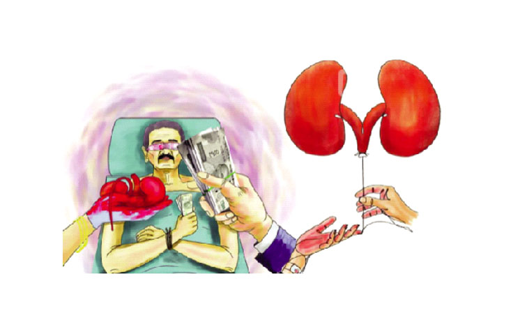 kidney_20df.jpg