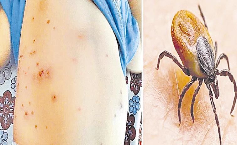 SCRUB-TYPHUS.jpg