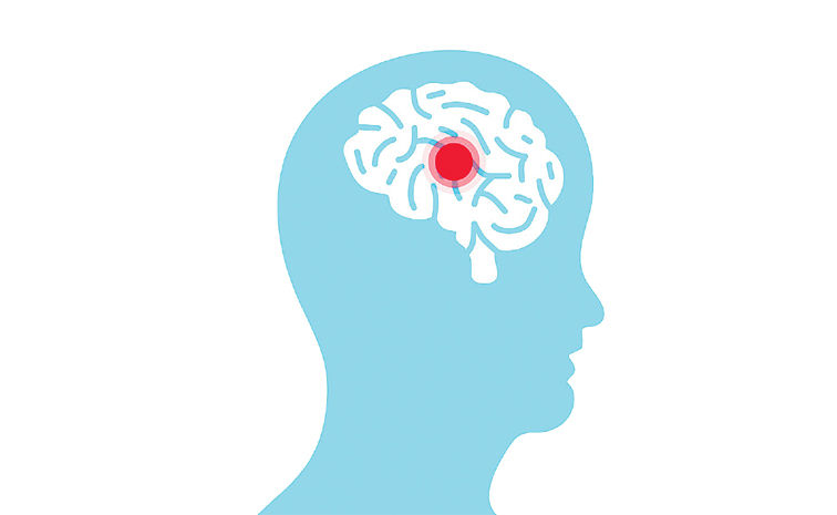 brain.jpg
