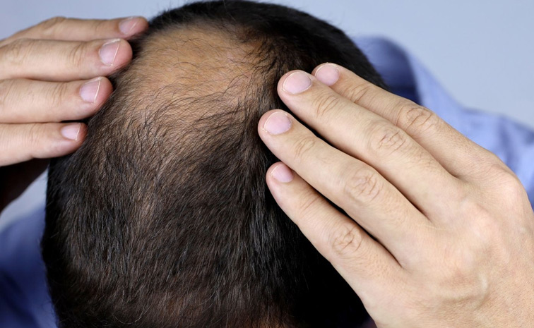 hair-loss.jpg