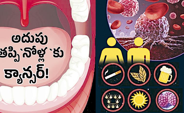 MOUTH-CANCER1.jpg