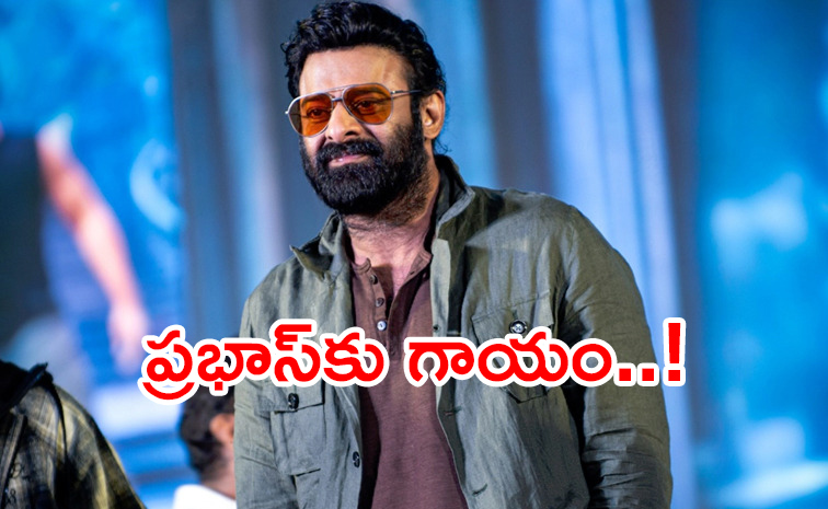 Prabhas-injured.jpg