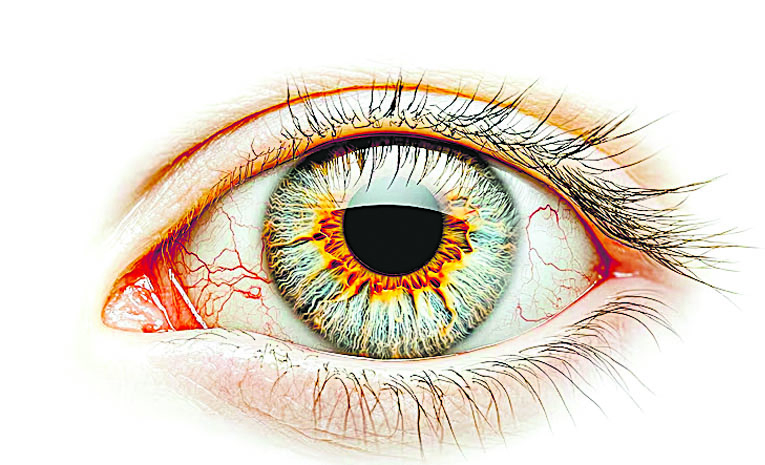 Eye.jpg