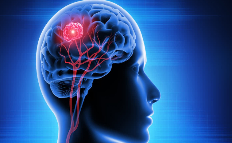 braintumerdayy2026.jpg