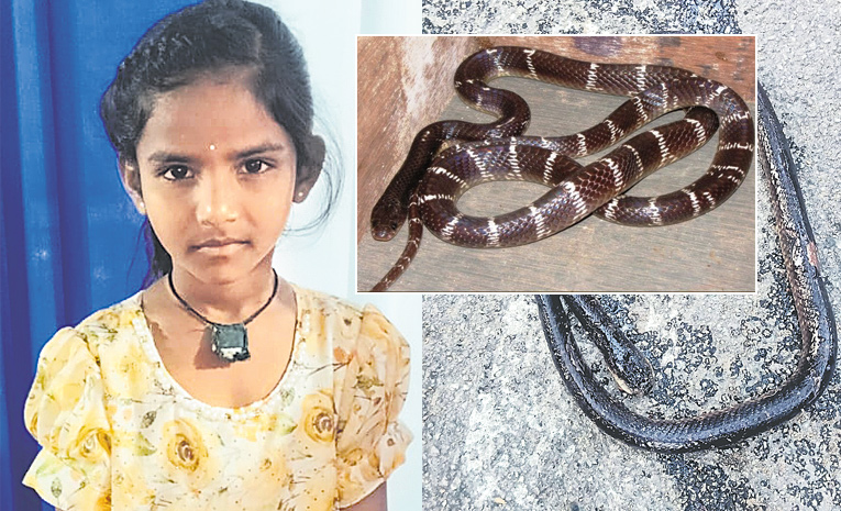Snake-bites.jpg