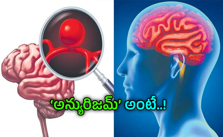 brain.jpg