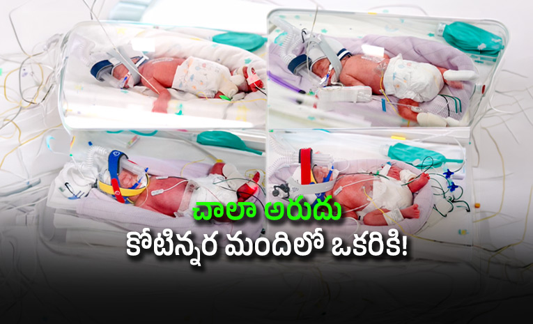 Australian-Woman-Gives-Birth-to-Quadruplet-Girls-Now-Seeking-Help-To-Buy-10-Seater-Car_0.jpg