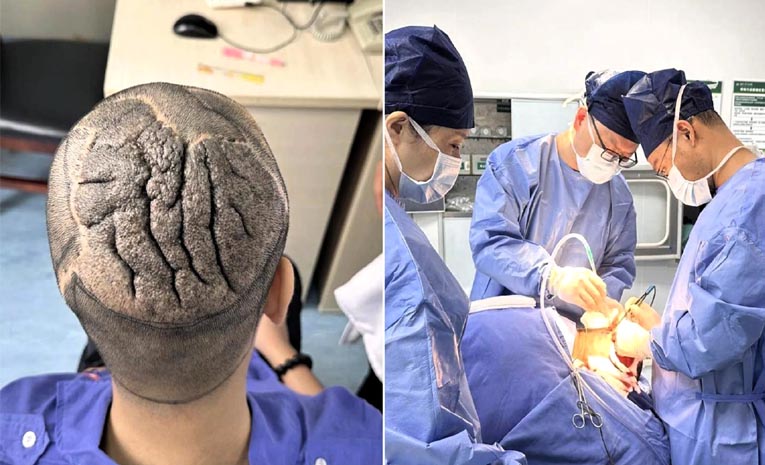 brain.jpg