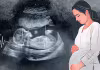 ఆడనే చంపేస్తున్నారు!