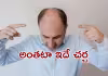 బట్టతలపై జుట్టు.. &lsquo;మ్యాజిక్ క్యాప్&rsquo;తో ఊహకందని అద్భుతం!