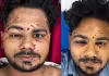ఢిల్లీ నిరసనల్లో పెల్లెట్ గాయాల భయానక నిజాలు!